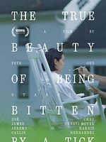 Poster der The True Beauty Of Being Bitten By A Tick