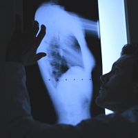 Bilder Thibault Vinçon