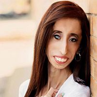 Bilder Lizzie Velasquez