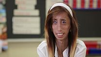 Bild von A Brave Heart: The Lizzie Velasquez Story Trailer OV