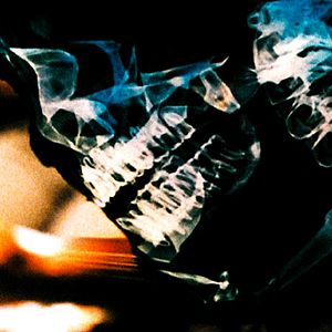 Bilder Hukkle - Das Dorf