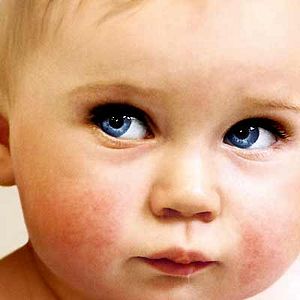 Bilder Arthur Peyret