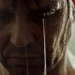 Bilder Carne De Perro