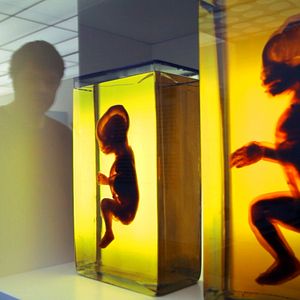 Bilder Das dunkle Gen