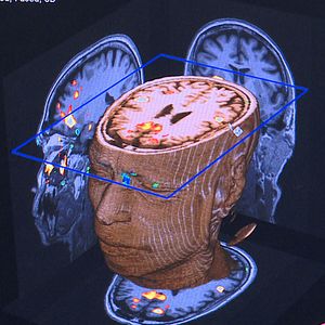 Bilder Poétique du cerveau