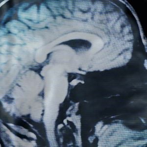 Bilder Los pájaros no tienen vértigo