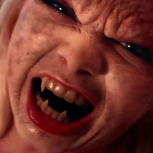 Bilder Patient Seven