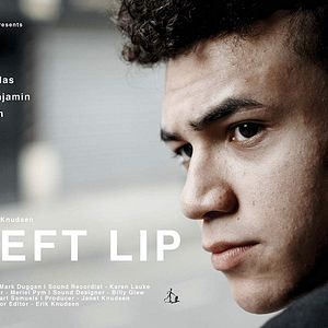 Bilder Cleft Lip