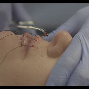 Bilder Slashed - Aufgeschlitzt