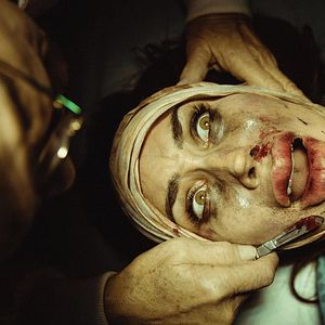 Bilder Incision - Kleine Einschnitte, große Schmerzen