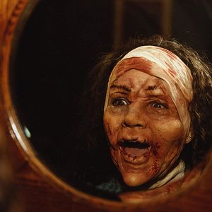 Bilder Incision - Kleine Einschnitte, große Schmerzen