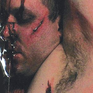 Bilder Pray for Dawn - Bunker der Schmerzen