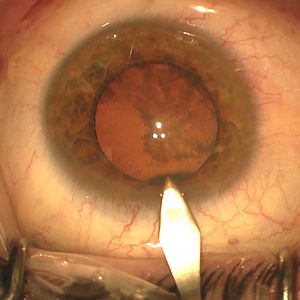 Bilder The Story of Looking