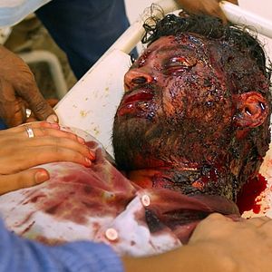 Bilder Virus - unsichtbarer Tod