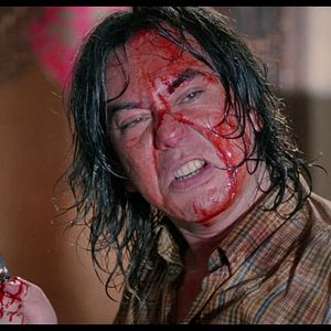 Bilder Ebola Syndrome