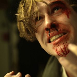 Bilder Skal - Fight For Survival