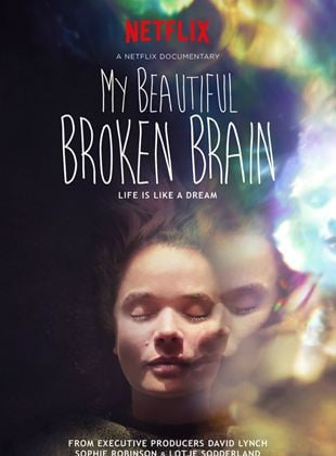 My Beautiful Broken Brain