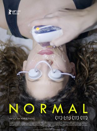  Normal