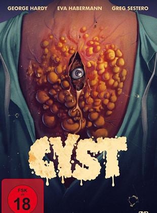Cyst (2020) stream konstelos