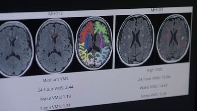 bild aus der news Es betrifft die Hälfte der Weltbevölkerung und ist trotzdem kaum erforscht: Deutscher Trailer zu "Mein neues altes Ich" - exklusiv bei FILMSTARTS