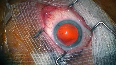 bild aus der news Krasser als jeder Horrorfilm: Echte Leichen und Innereien treiben Publikum massenweise aus dem Kinosaal