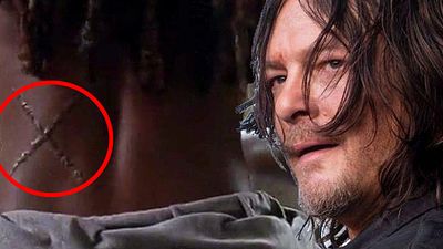 bild aus der news "The Walking Dead": Was hat es mit den geheimnisvollen Narben auf sich?