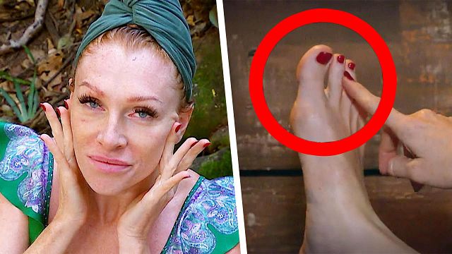 bild aus der news Dschungelcamp-Star unterzog sich skurriler Beauty-OP – und bekam dafür 5.000 Euro