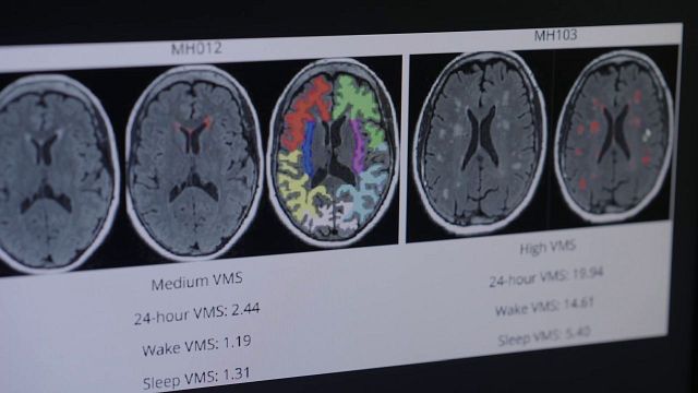 bild aus der news Es betrifft die Hälfte der Weltbevölkerung und ist trotzdem kaum erforscht: Deutscher Trailer zu "Mein neues altes Ich" - exklusiv bei FILMSTARTS