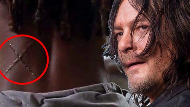 bild aus der news "The Walking Dead": Was hat es mit den geheimnisvollen Narben auf sich?