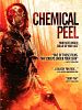 Poster der Chemical Peel