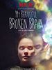 Poster der My Beautiful Broken Brain