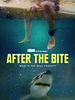 Poster der After The Bite