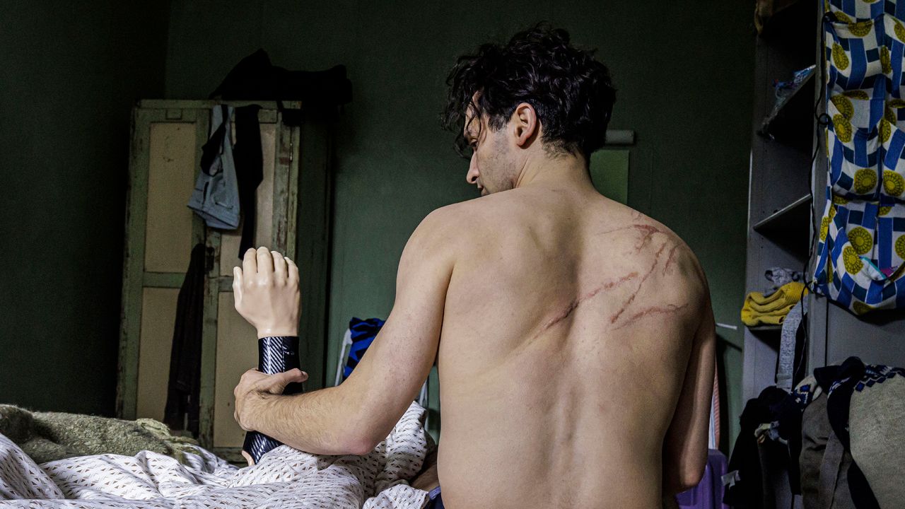 Hassan Akkouch ist als einarmiger Musiker Omar die zweite Hauptfigur in 