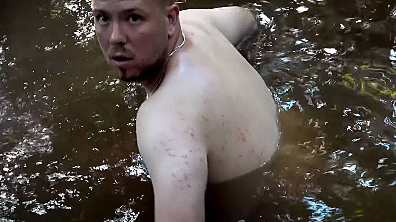 Gaming-Influencer AviveHD hat im Trailer mit schwerem Ausschlag zu kämpfen.