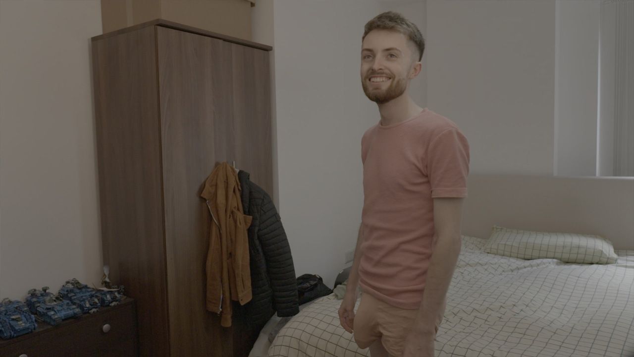 Joes Beule sorgt oft für ungewollte Aufmerksamkeit.