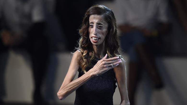 A Brave Heart: The Lizzie Velasquez Story : Bild